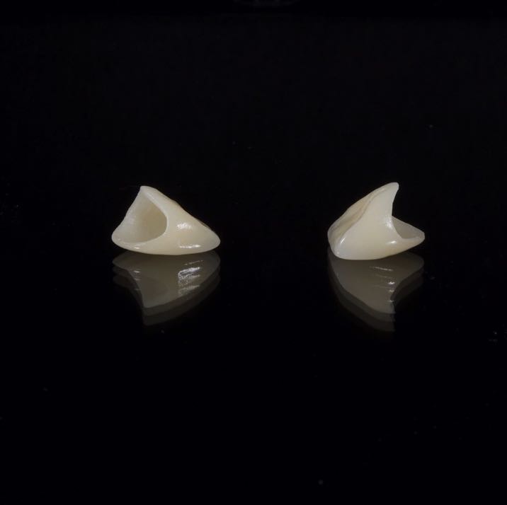 dental-2036941_1920 2