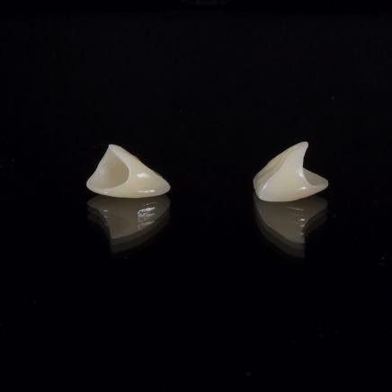 dental-2036941_1920 2